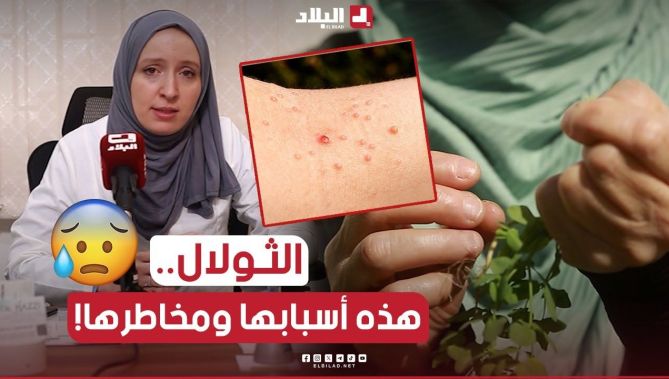 الثآليل.. عـ.. ـدوى فيـ.. ـروسية جلدية قد تتحول في بعض الحالات إلى مـ.. ـرض خبــ.. ـيث 😰