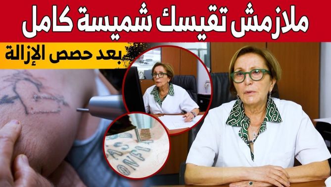 الدكتورة "بن تومي ميمي" تشرح بالتطبيق عن طريقة إزالة الوشم من الجسم ومايتوجب تفاديه بعد ذلك