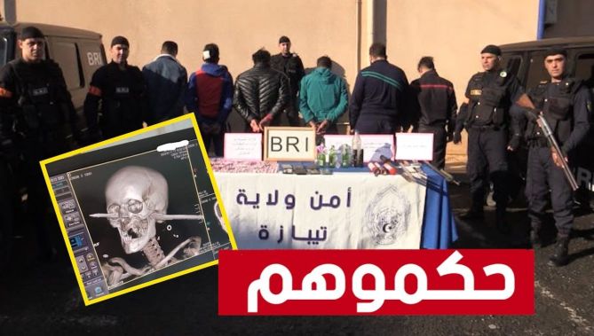 مصالح #شرطة #تيبازة تتمكن من توقيف المشتبه فيهم في قضية الإعتداء على مواطن بواسطة سلاح صيد بحري