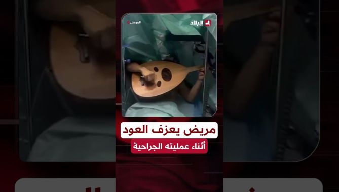 مريض يعزف العود داخل غرفة العمليات أثناء إزالة ورم من دماغه تحت التخدير الموضعي 😲