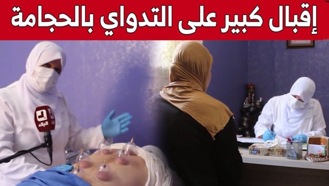 مراكز الطب البديل بمستغانم تشهد إقبالا لافتا على التداوي بالحجامة.. شاهد