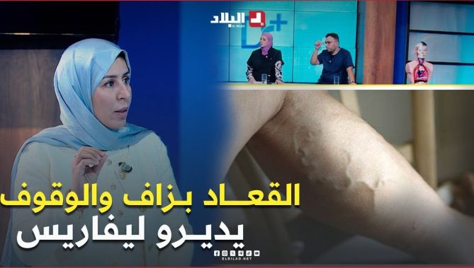 إذا عندك واحد في الدار مريض بـ "ليفاريس" ممكن بزاف يحكموك نتا تانعامل الوراثة على مرض دوالي الساقين"