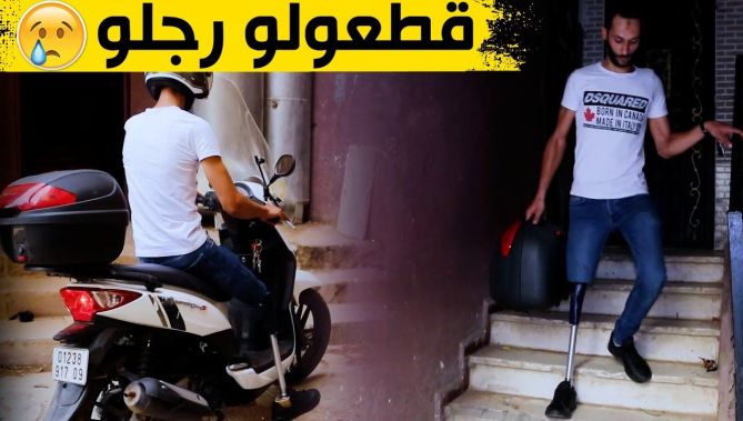 تعرفوا على قصّة "فازيل" الذي بـ.ـترت رجله جرّاء حـ.ـادث مرور مـ.ـميت سببه سائق سيارة متهور .. شاهدوا