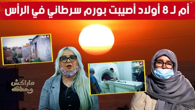 برنامج #ماراكش_وحدك.. خالتي فاطمة أم لـ8 أولاد تعاني من ورم سرطاني في الرأس ومنزلها يعاني الإهتراء..
