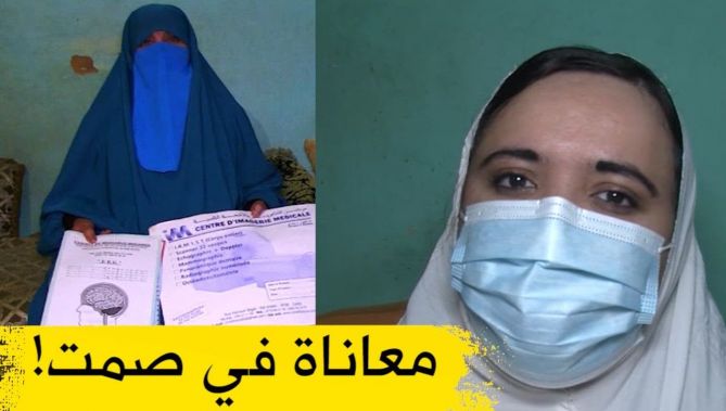 الشابة "عينونة" من ولاية سعيدة تعاني في صمت بعد أن نخر جسمها مرض "داء الفيل"