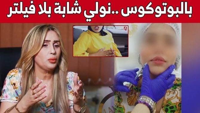 صانعة محتوى تروي تجربتها مع حقن للبوتوكس والفيلر... شاهدوا