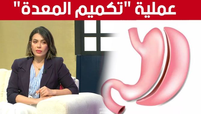 تعرف على مخاطر ومضاعفات عملية "تكميم المعدة" ومتى ينصح الطب بإجرائها.. شاهدوا