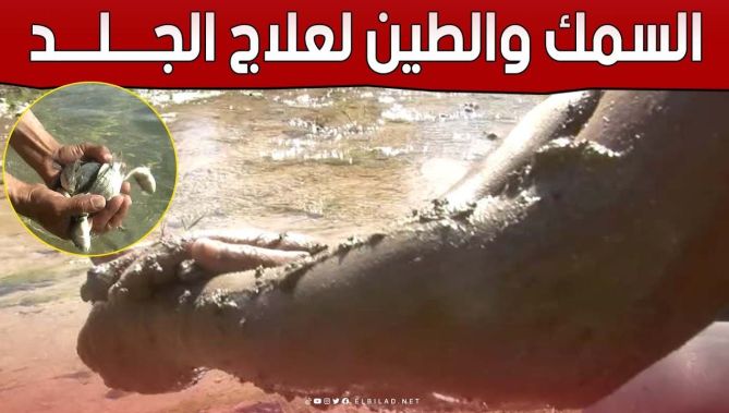 "منابع الطين" و"سمك التيلابيا" لعلاج الأمراض الجلدية بعين السخونة في #ســعـيـدة.. شاهد: