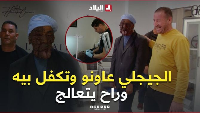 لفتة إنسانية من #الجيجلي تُغيّر مسار حياة #عبد_الحفيظ من #خنشلة، وستُجرى له عملية تجميلية 😍🥰🥹