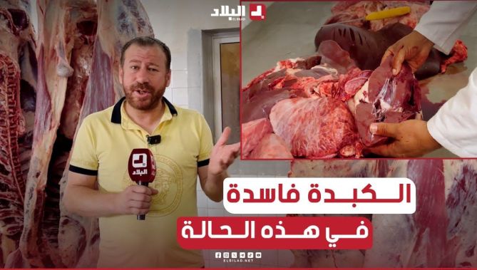 📌#طبيب_بيطري يتحدث عن الطريقة الصحيحة والمؤشرات لمعرفة إلا الكبد تاع الكبش فاسد شاهدوا