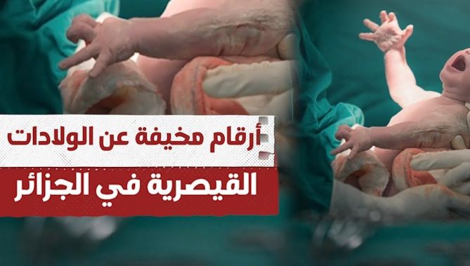 أرقام مخيفة عن ظاهرة الولادات القيصرية في الجزائر.. شاهد: