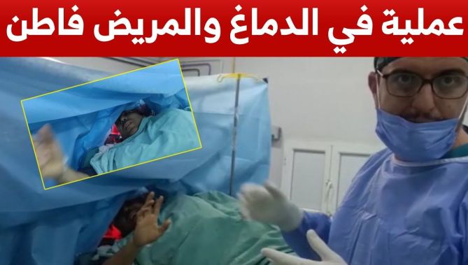 طاقم طبي شاب يقوم بعمليات جراحية في الدماغ والمريض مستيقظ..شاهدوا