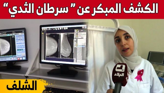 إقبال واسع من النساء للكشف المبكر عن سرطـ..ان الثدي بولاية الشلف.. شاهدوا