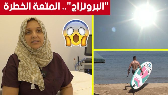 "البرونزاج" ...التعرض لأشعة الشمس للحصول على بشرة ذهبية اللون ..لكن شاهدوا مضاعفاتها 😨