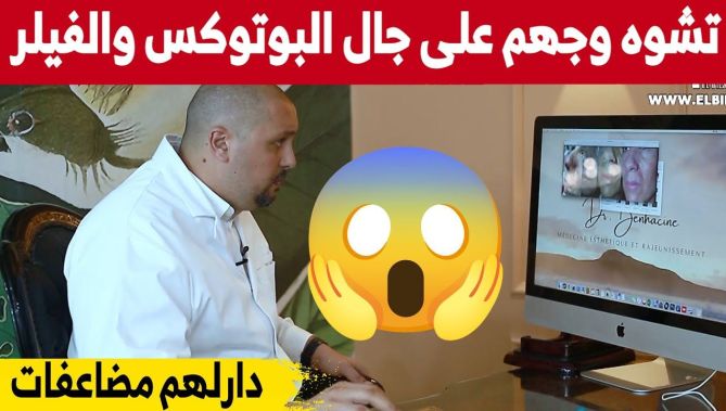 مختصون في الطب التجميلي يحذرون من الخضوع لعمليات تجميل غير جراحية في فضاءات غير طبية... شاهدوا