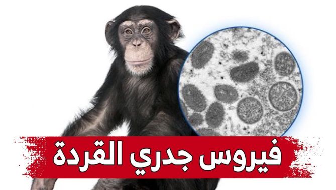 "جدري القردة" .. فيروس جديد يثير إهتمام العالم ومخاوفه